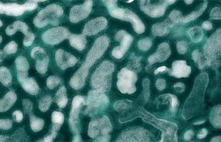 microscope_h5n1virus