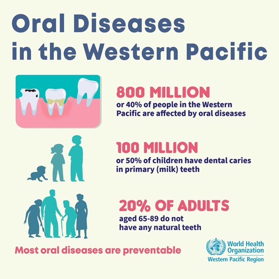 Burden of oral diseases in the Western Pacific